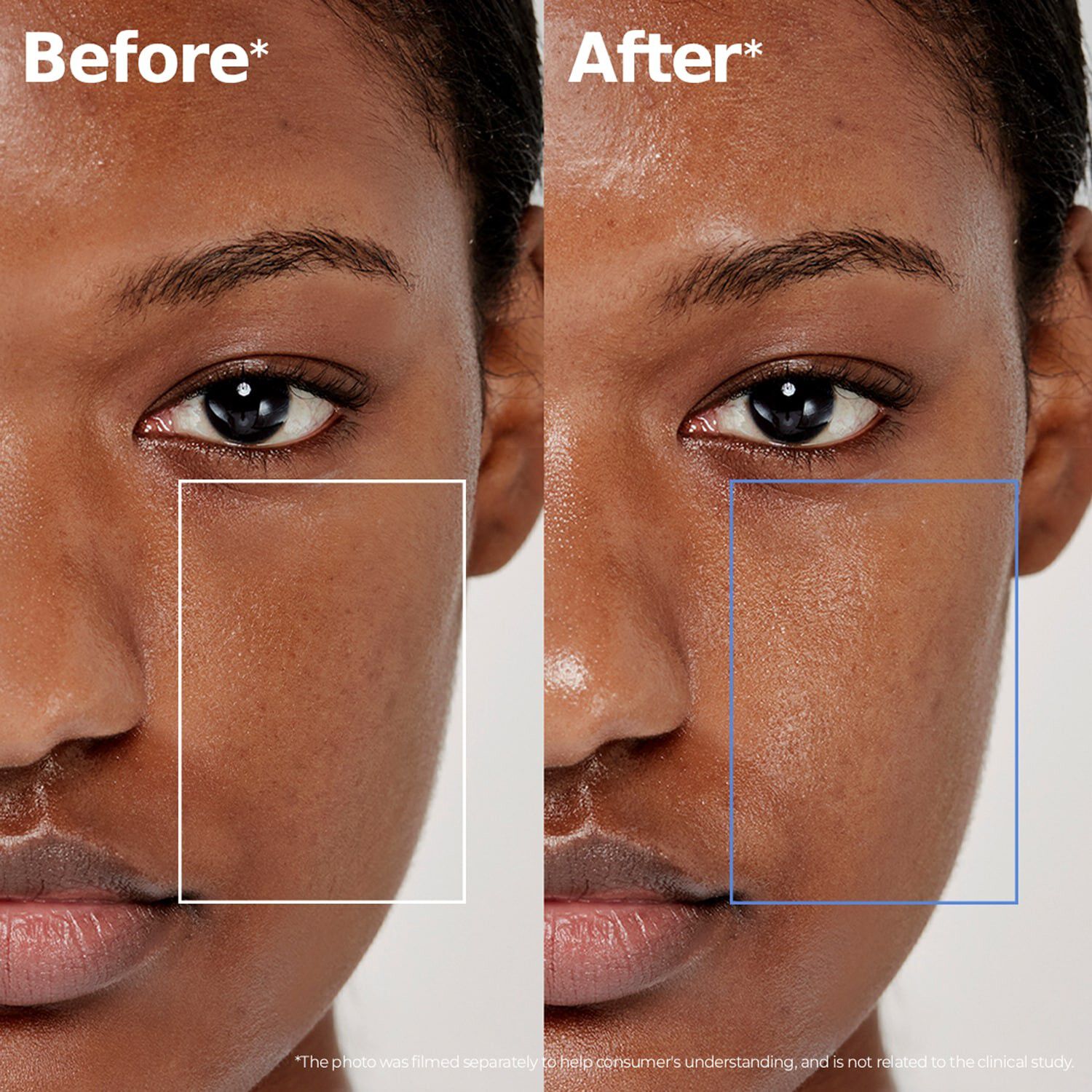 ATOBARRIER365 Lotion - Ansiktsvatten som &aring;terfuktar och st&auml;rker hudbar