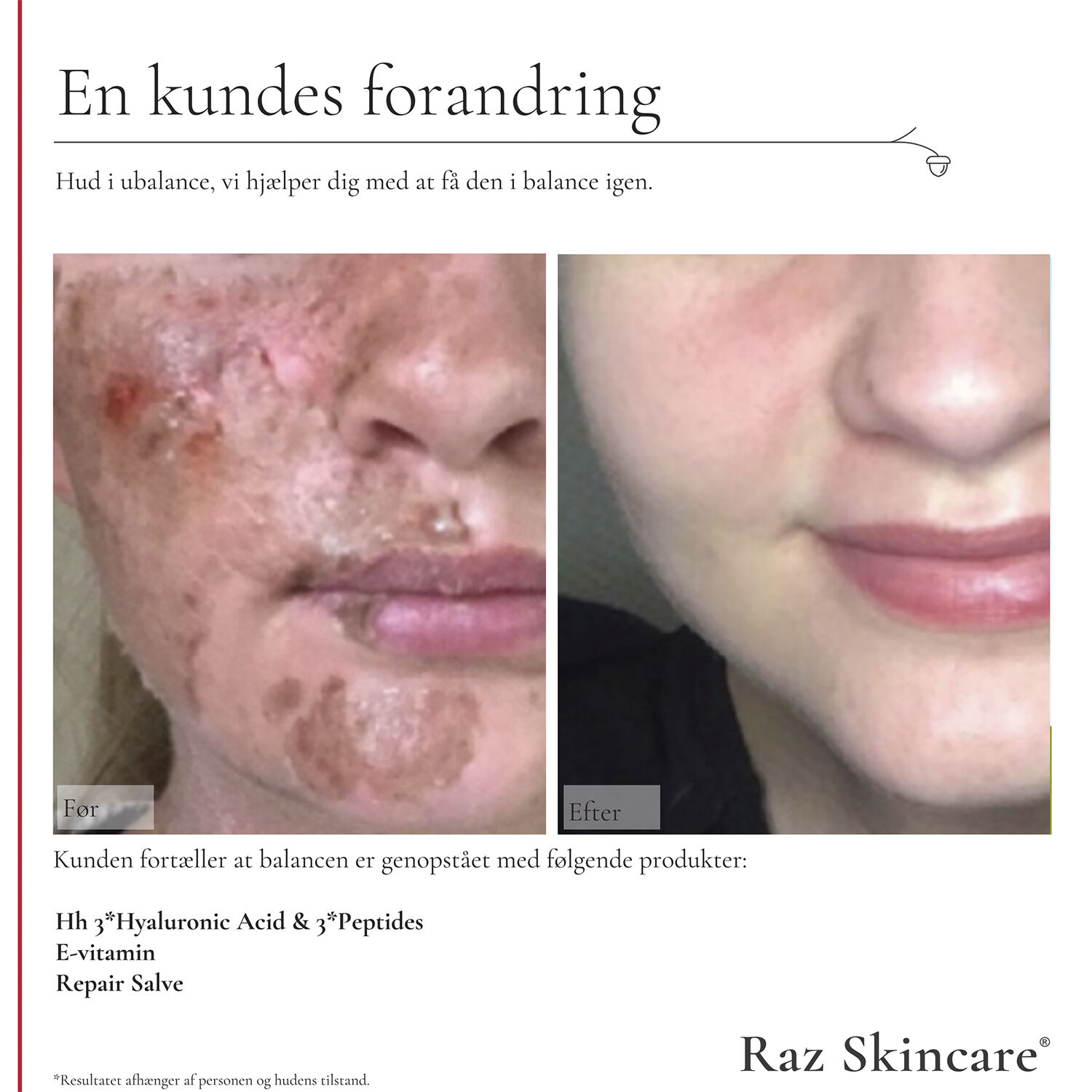 Reparationssalva, Parfymfri 15 ml