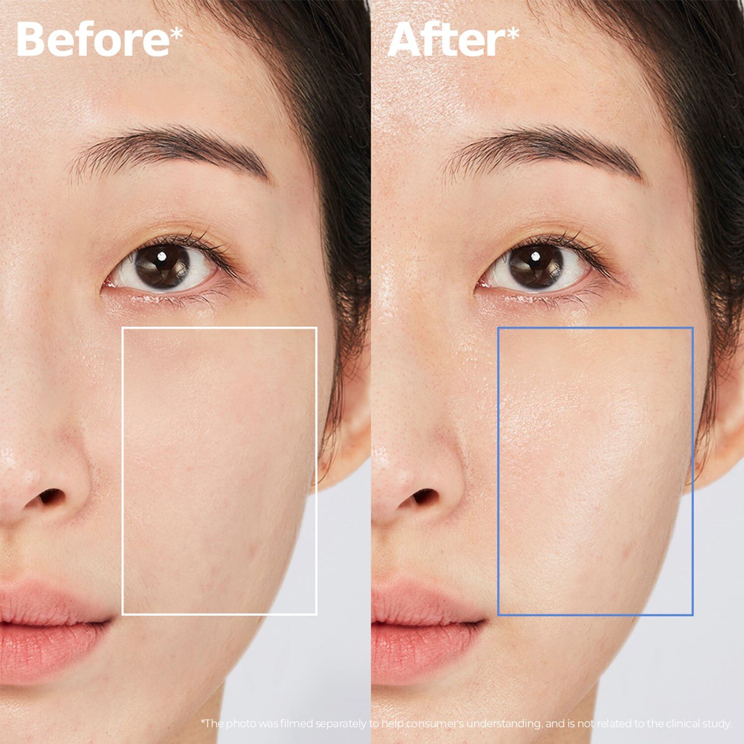 ATOBARRIER365 Cream - &Aring;terfuktande kr&auml;m som f&ouml;rst&auml;rker hudbarri&auml;ren