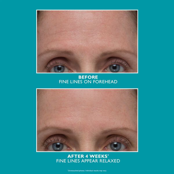 Peter Thomas Roth Peptide Skinjection Amplified Wrinkle-Fix Serum 30 m