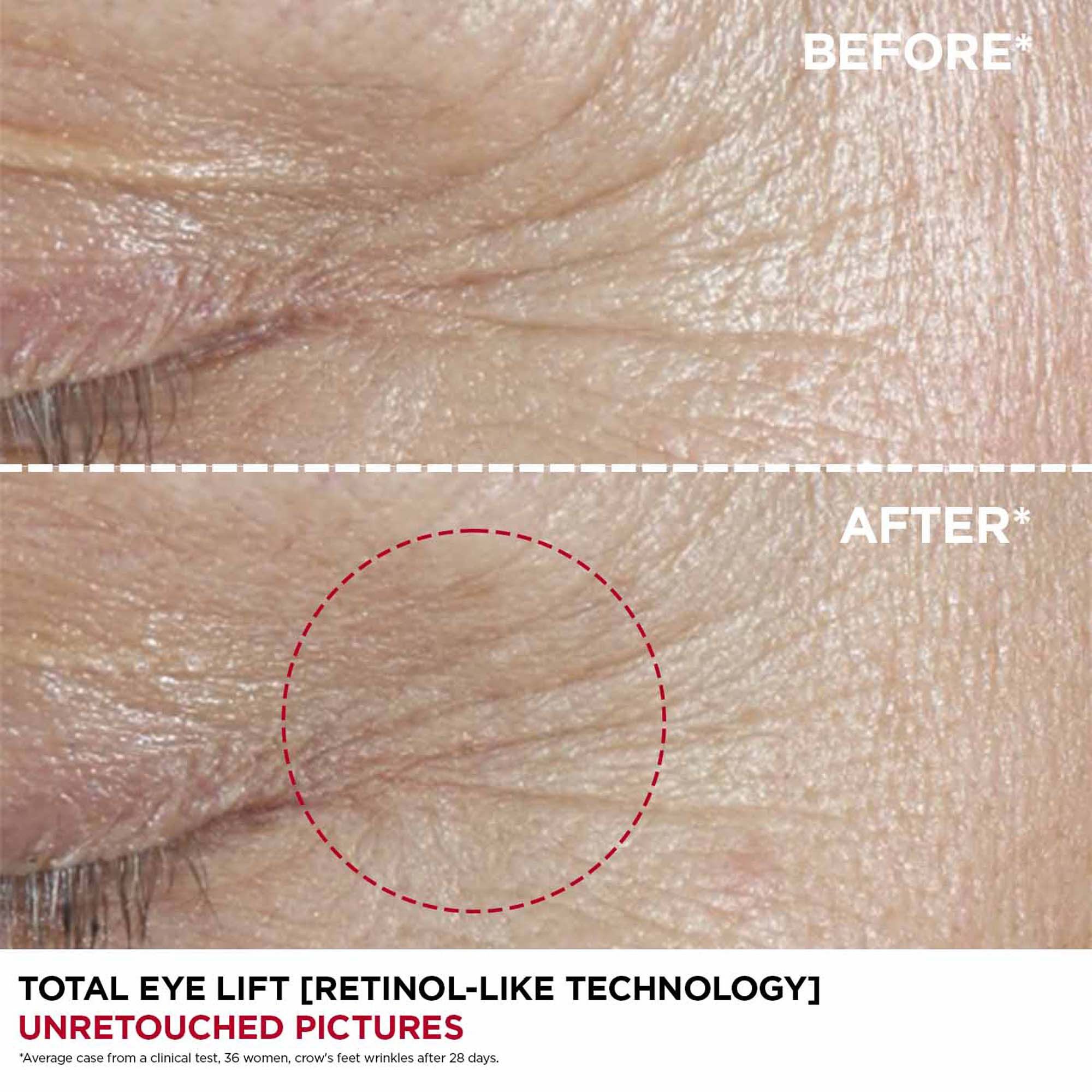 Total Eye Lift Refill