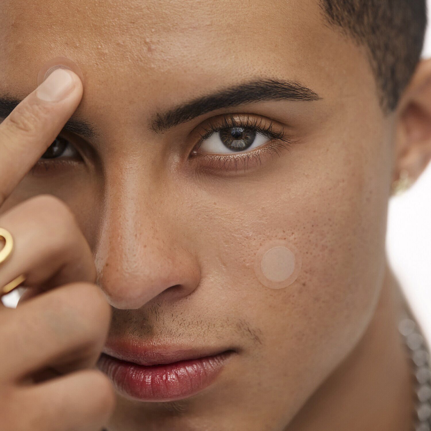 ACNE EARLY STAGE ACNE DOT 0. 74G