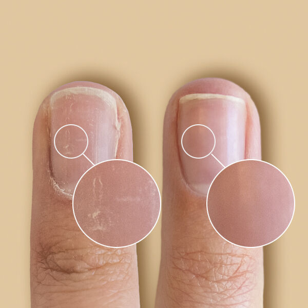 SolarOil Nail Care 3,7 ml