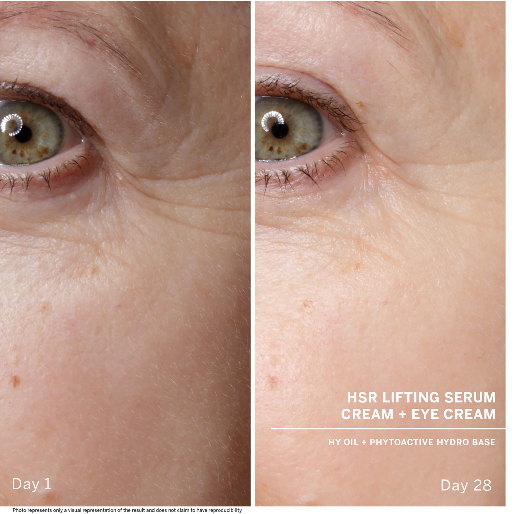 HSR anti-wrinkle serum
