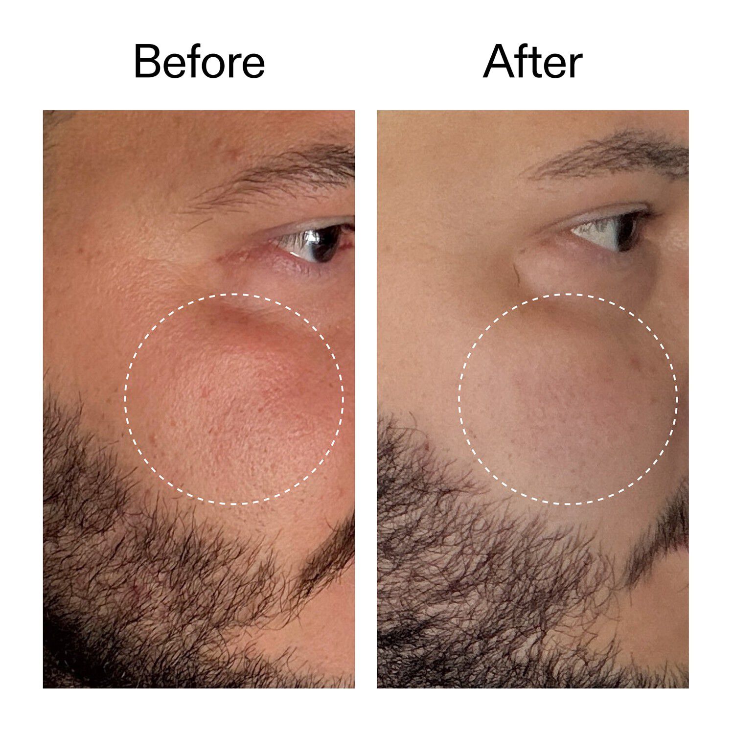 Starter Retinol Serum - Retinolserum f&ouml;r nyb&ouml;rjare