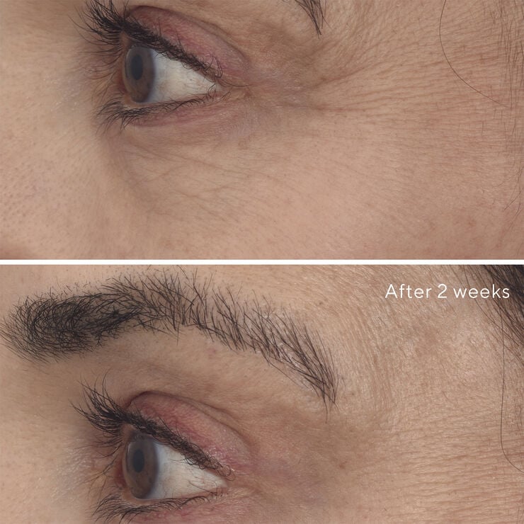 RETINAL RESCUPLT EYE TREATMENT 15 ML