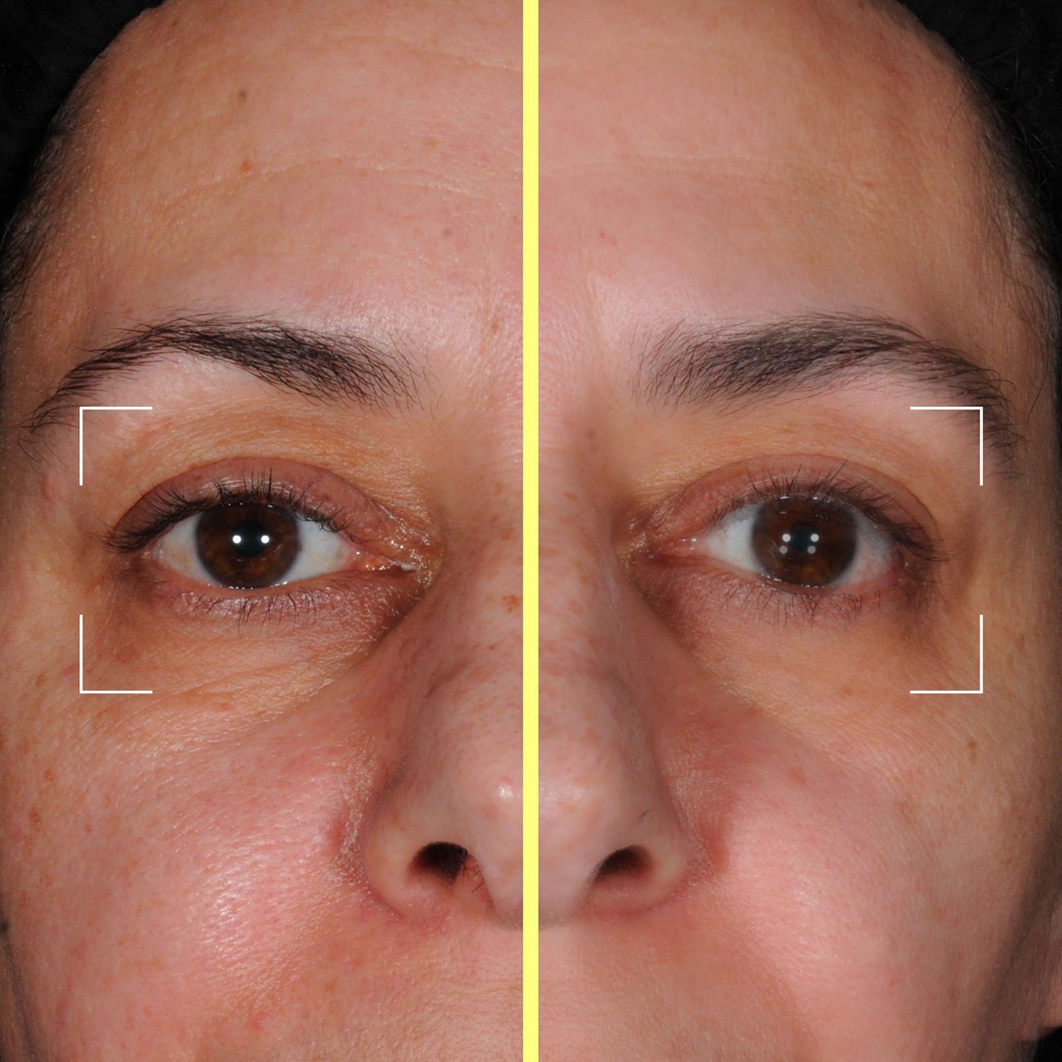 Eye Capsules - &Ouml;gonserum berikat med peptider, koffein och niacinamid