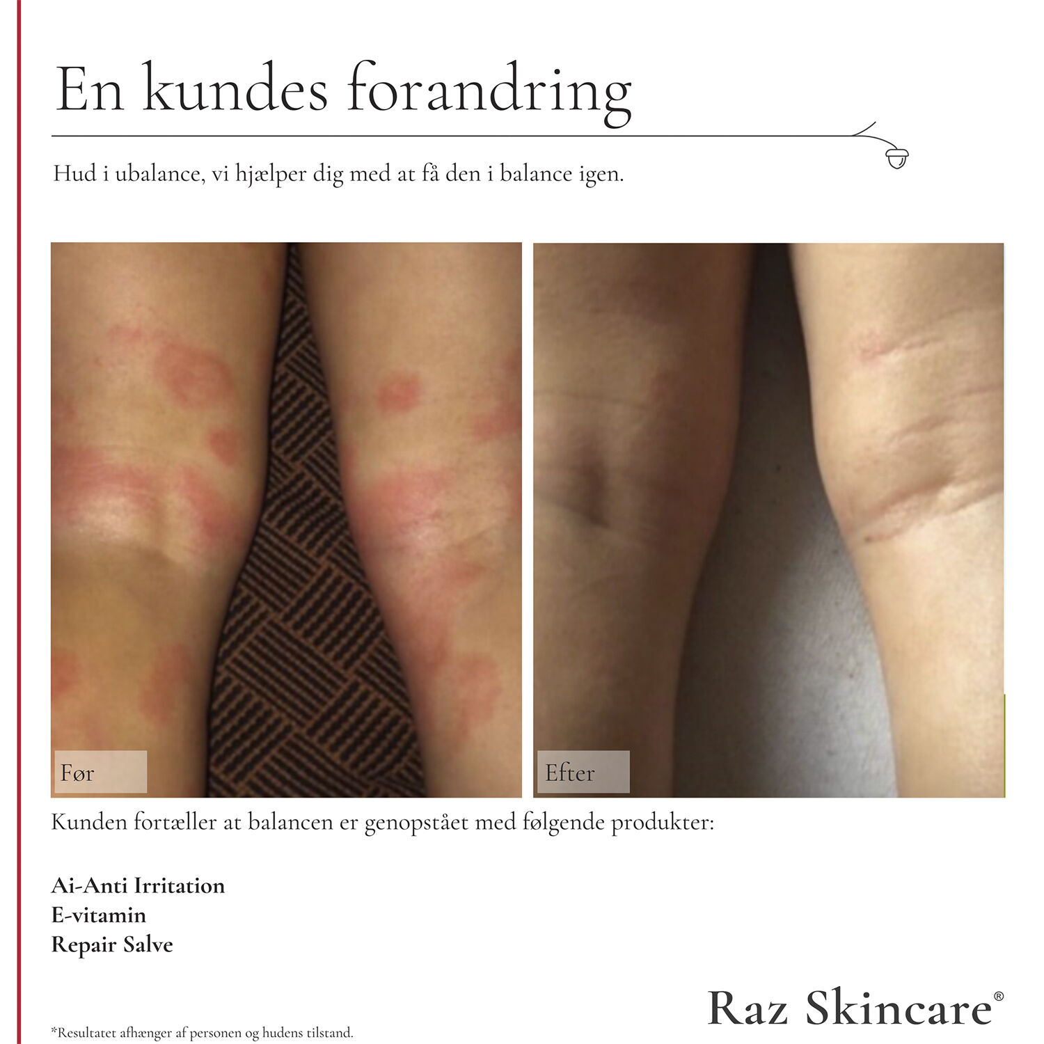 Raz Skincare Ai - Anti Irritation 300 ml