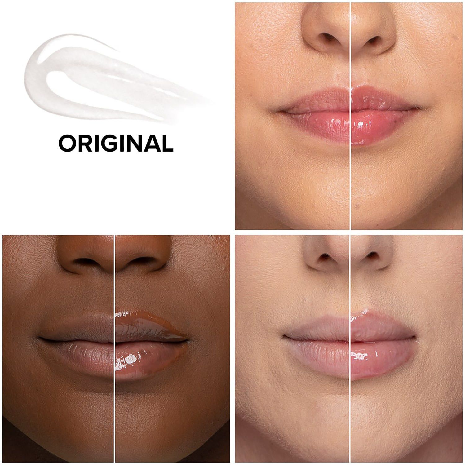 Lip Injection Extreme - Rejsest&oslash;rrelse