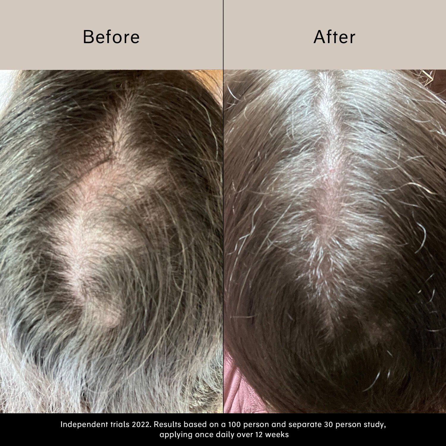 Pitta Growth Serum - Tillv&auml;xtserum