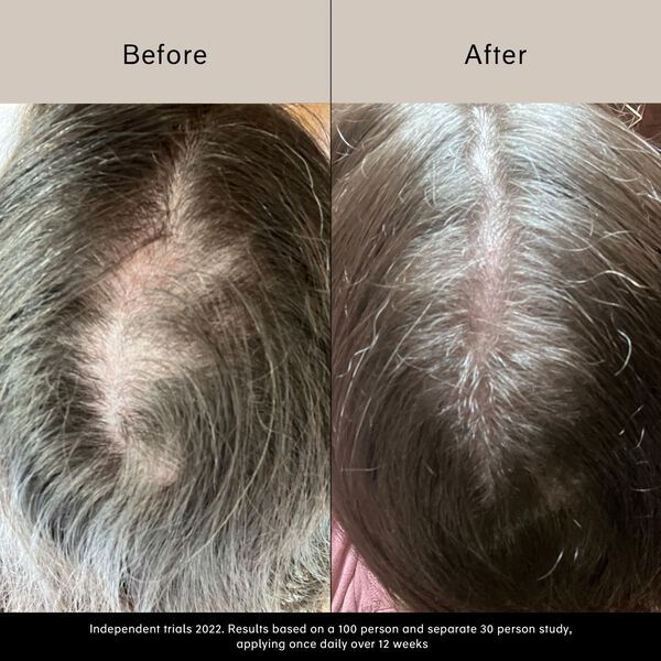 Pitta Growth Serum - Tillväxtserum