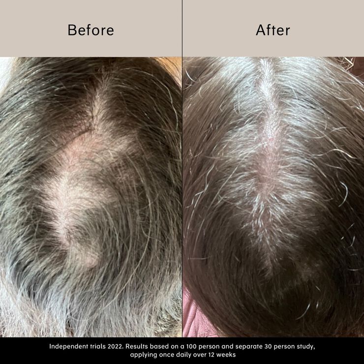 Pitta Growth Serum - Tillväxtserum