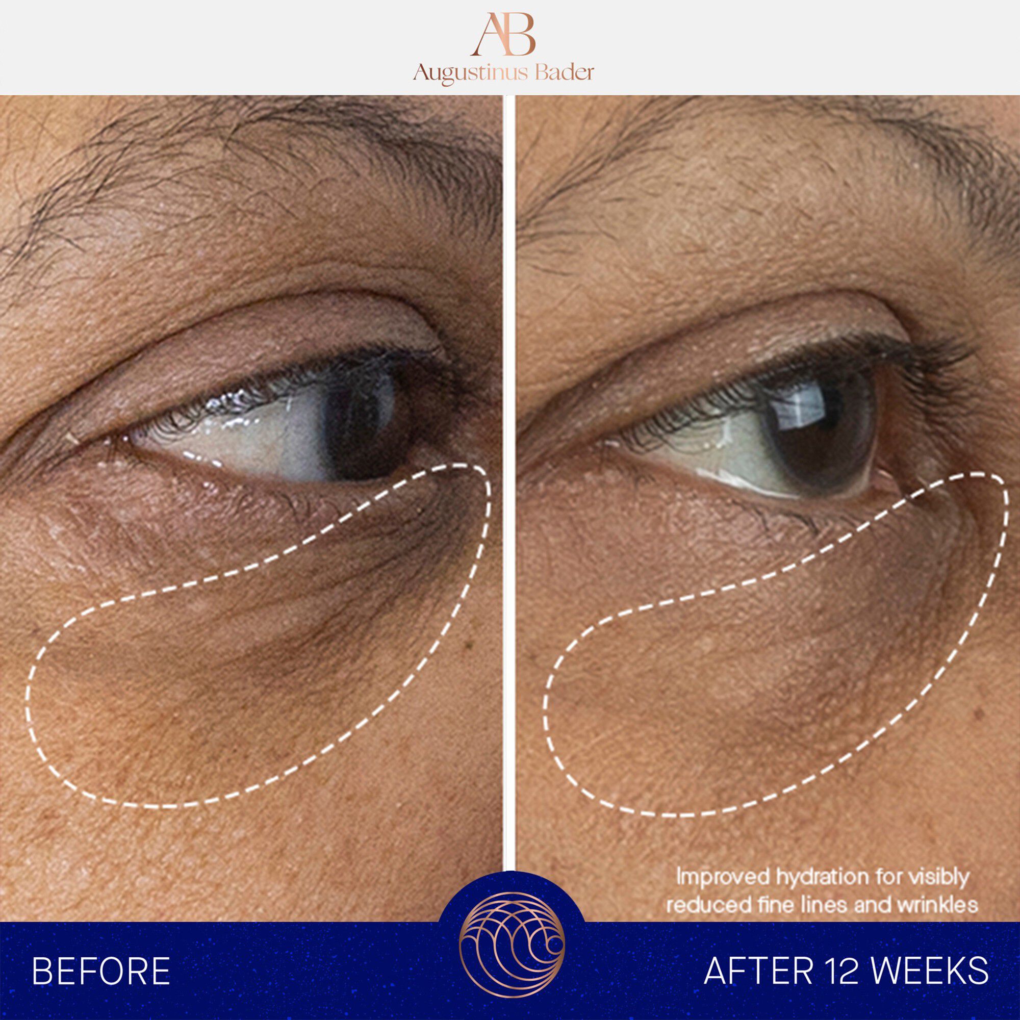 The Eye Cream Nomad 15ml