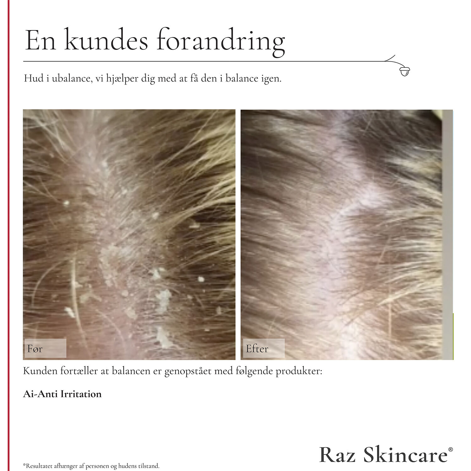 Raz Skincare Ai - Anti Irritation 300 ml