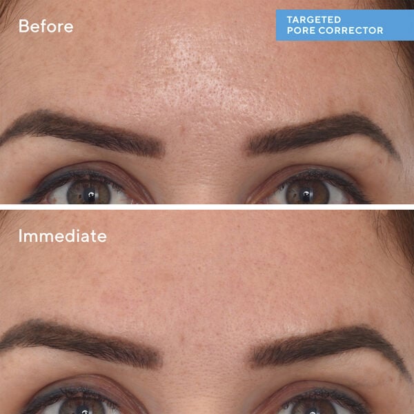 Targeted PoreCorrector 15 ml