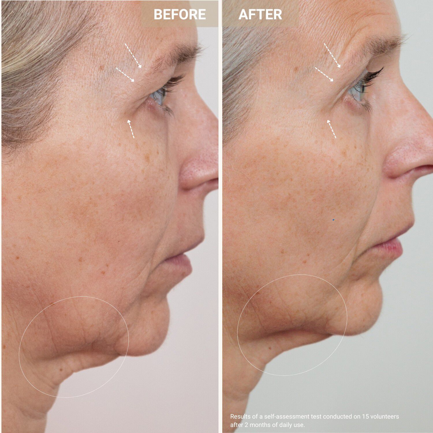 Youth Serum - Anti-aging-serum med kopparpeptider