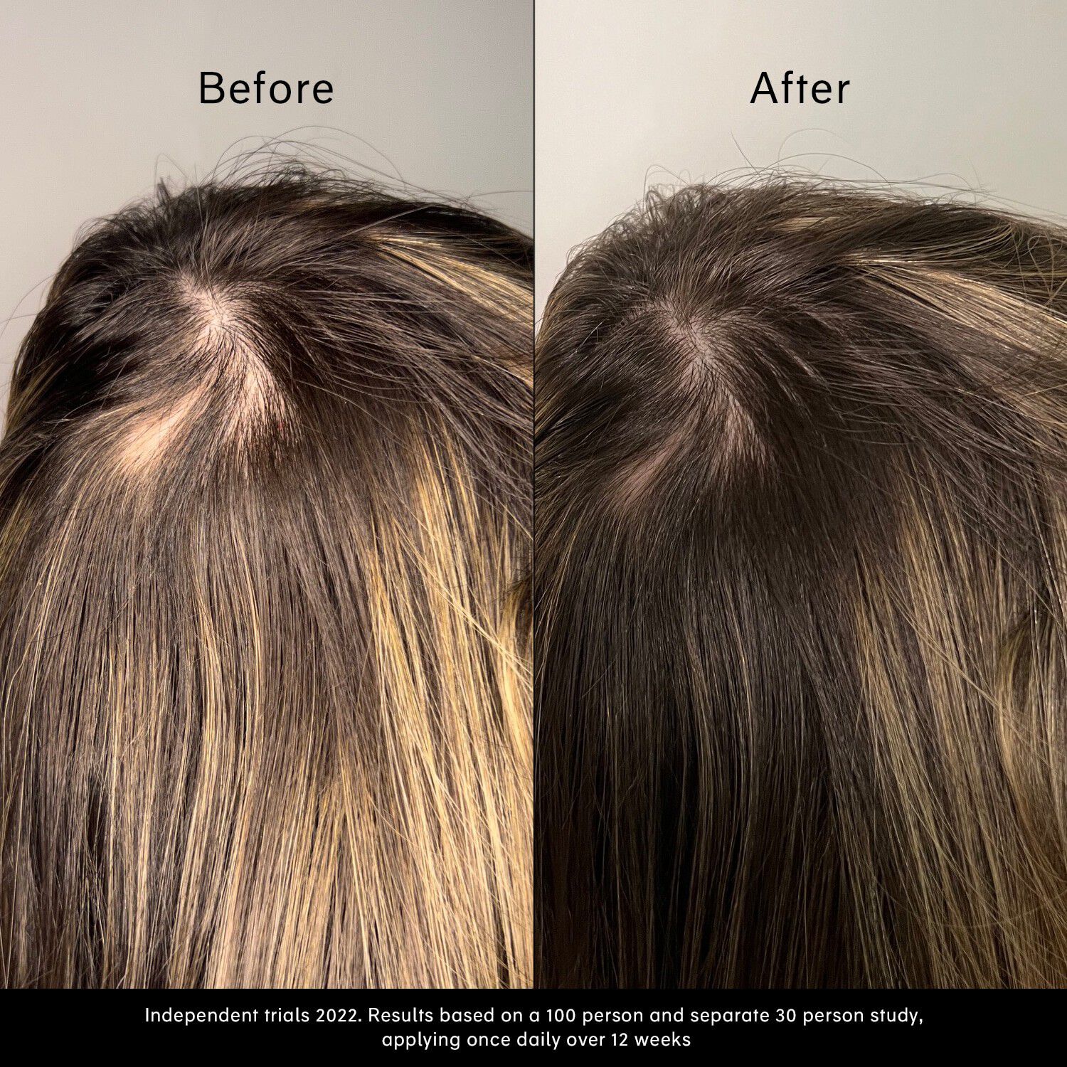 Pitta Growth Serum - Tillv&auml;xtserum