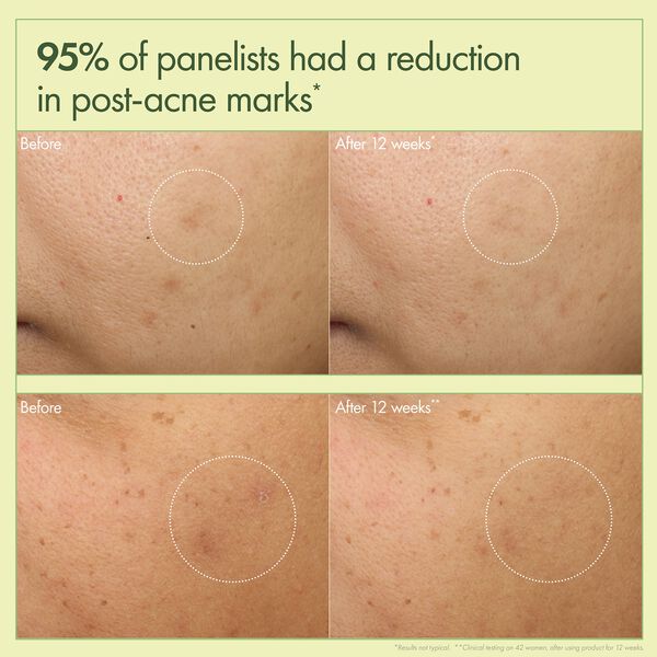 Dr. Weil Mega-Mushroom Dark Spot Correcting Brightening Moisturizer