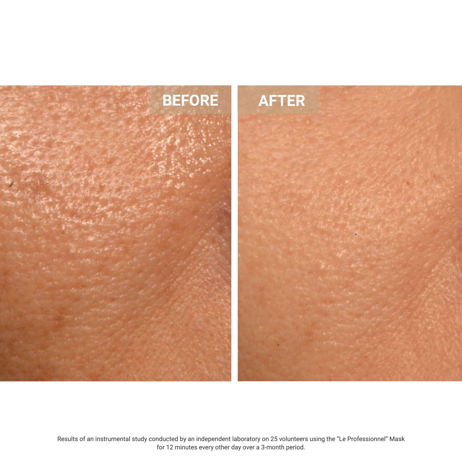 Aurion X252 LED Face Mask - Anti-aging LED-ansiktsmask