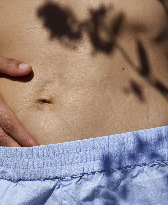 Love Lines - Strækmærke creme