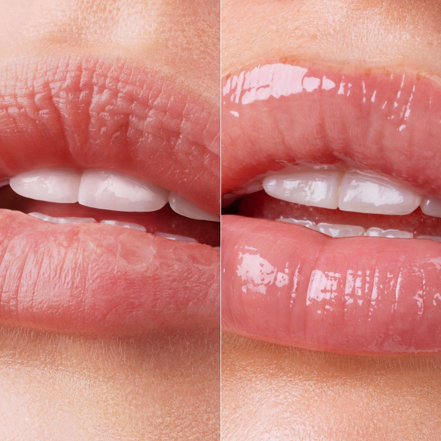 Lip Therapy Glaze Duo - Kit f&ouml;r l&auml;ppv&aring;rd