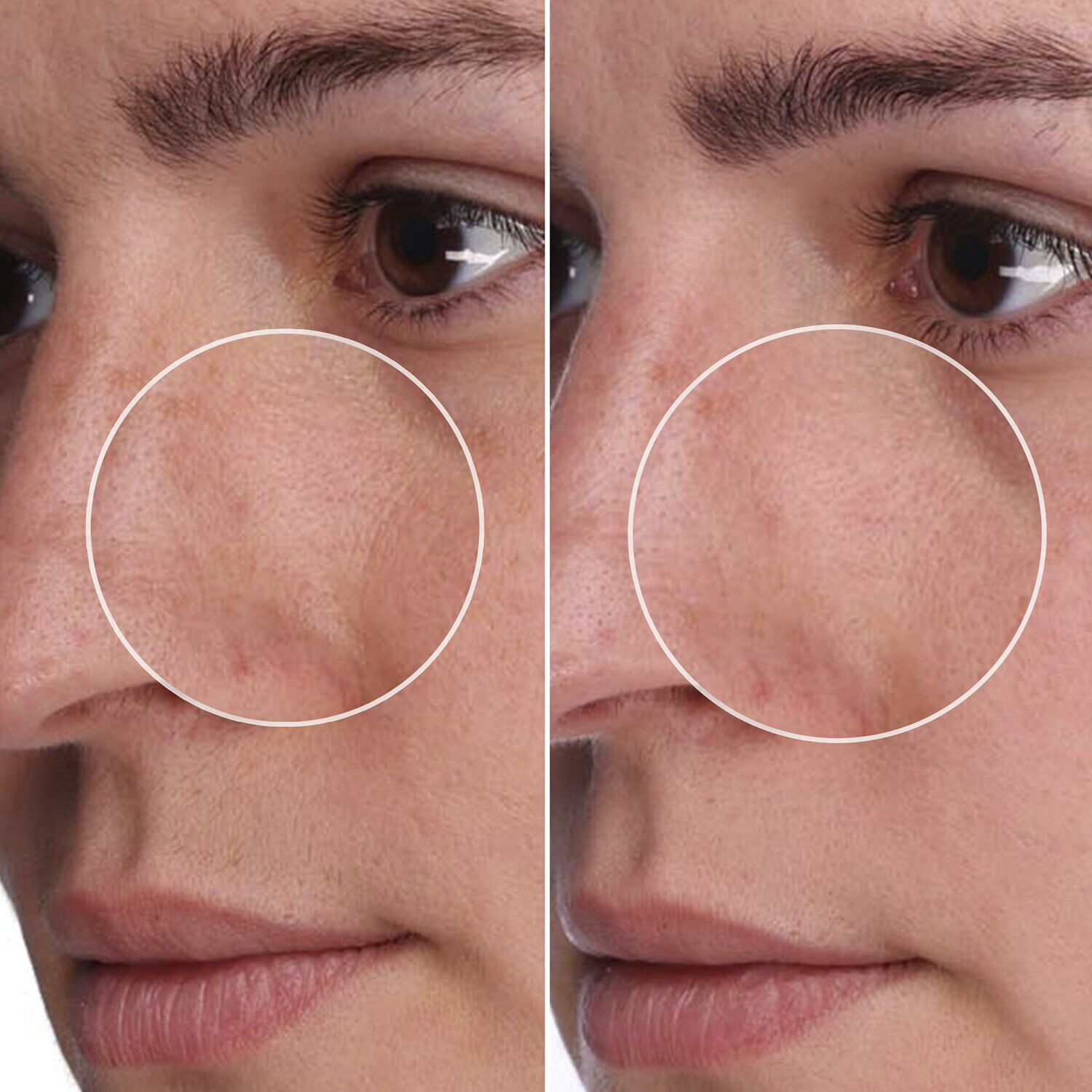 The POREfessional Shrink Wrap Porbehandling &ouml;ver natten med AHA+PHA