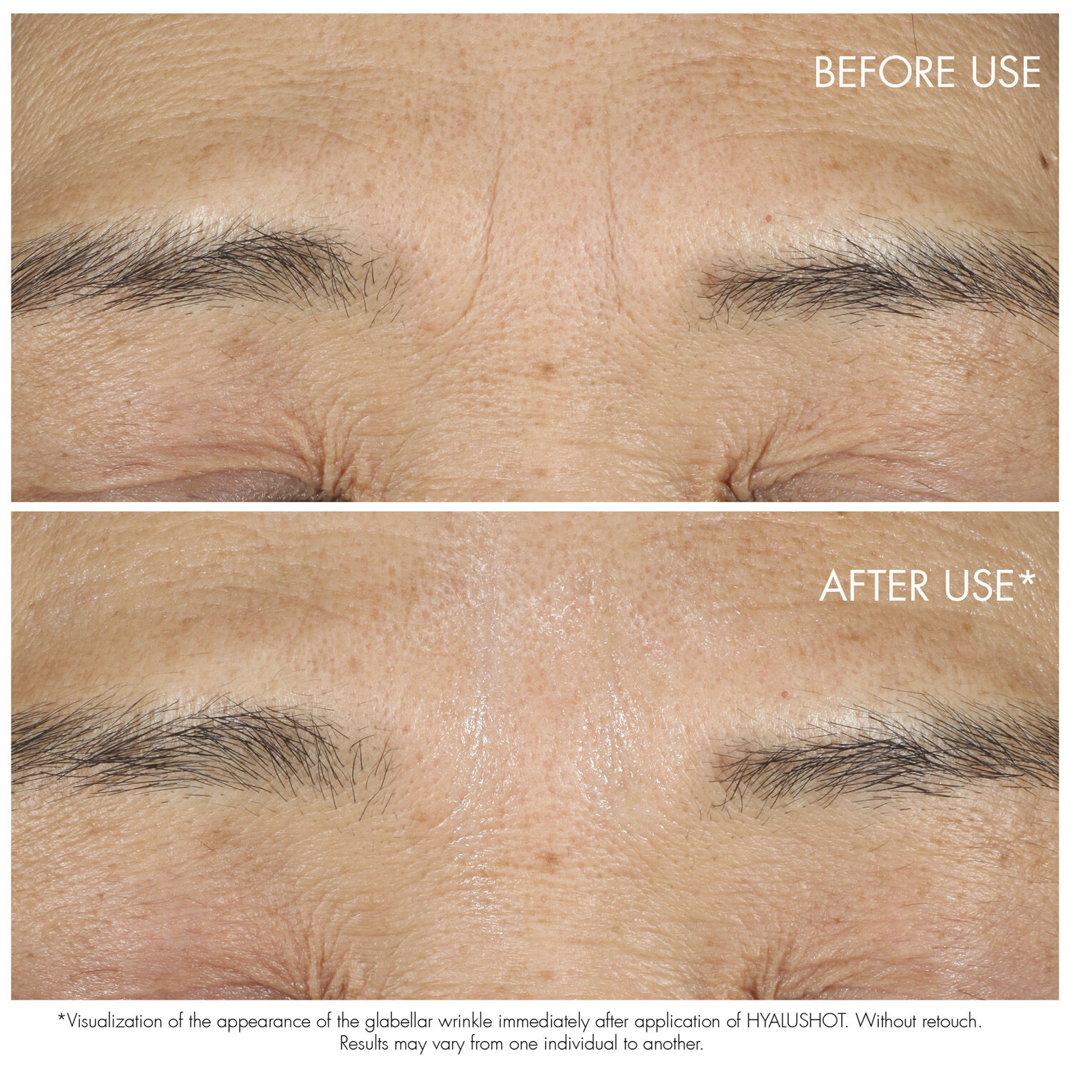 Capture Totale Retishot Retinol Night Concentrate