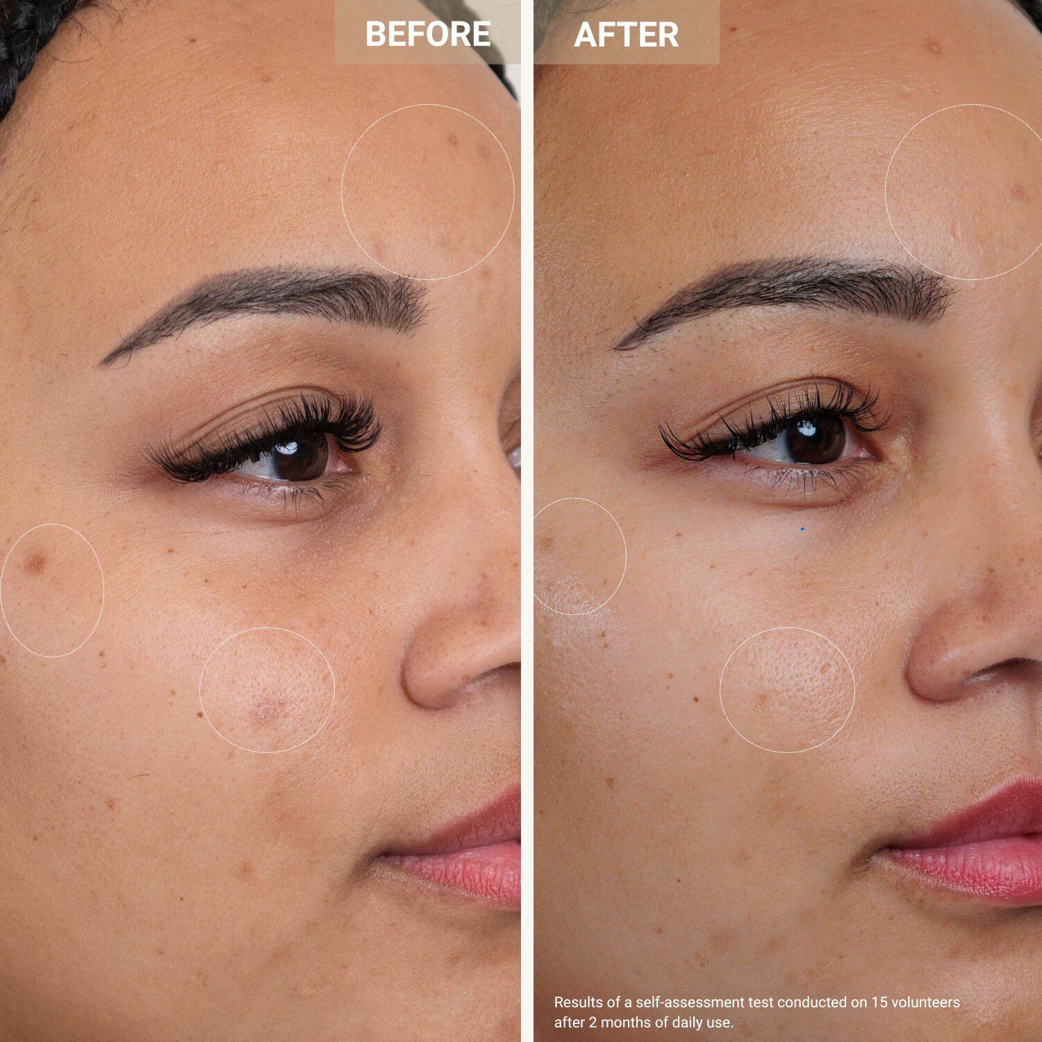 Anti-Redness Clarifying Care - Serum mot rodnad och orenheter