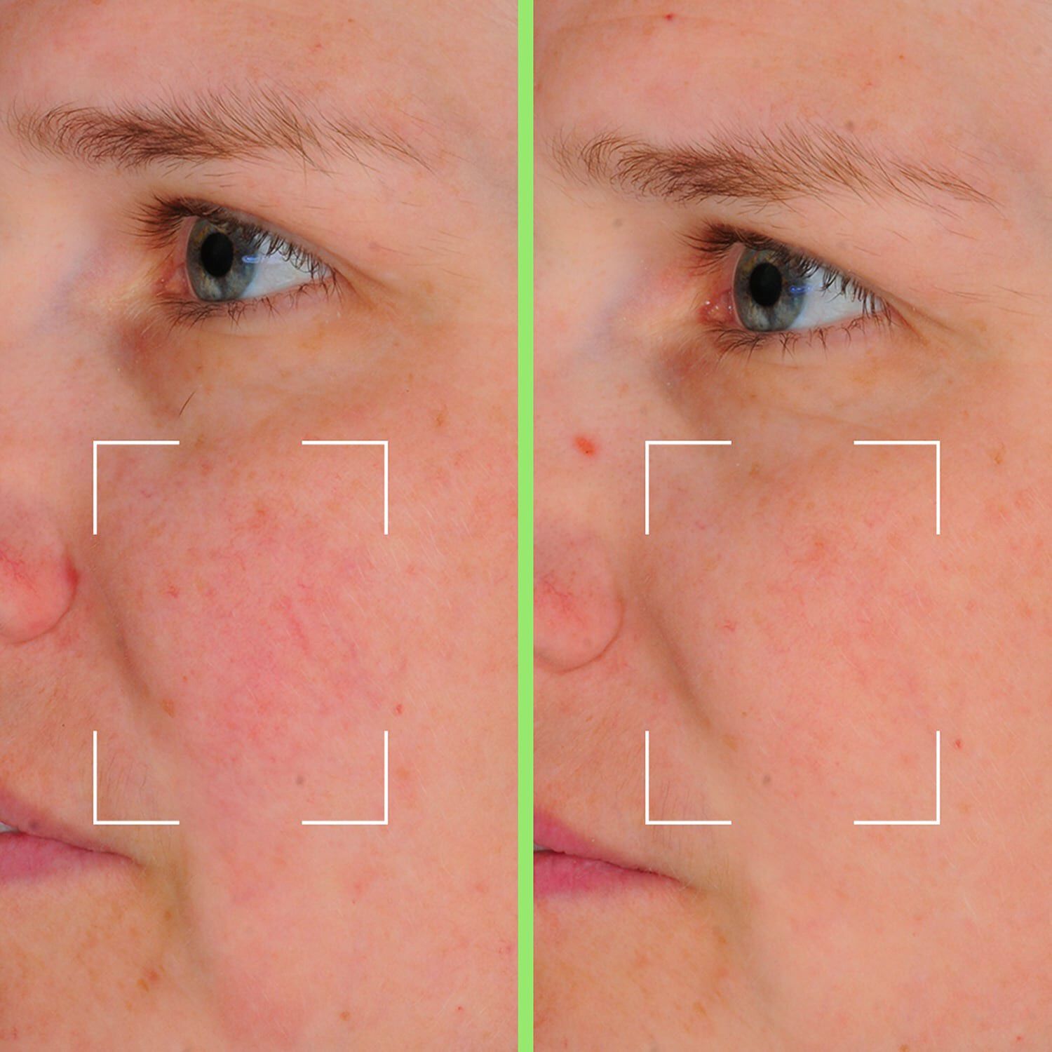 Skin Perfect Capsules - Vitaliserande serum med niacinamid, HA och vit