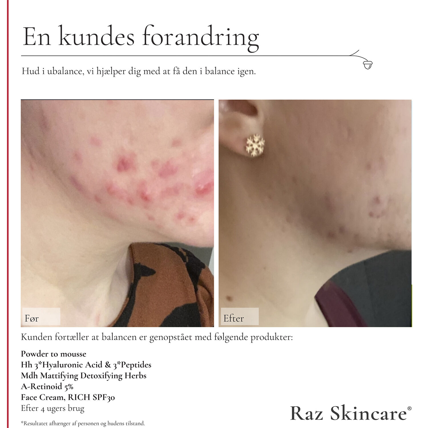 Raz Skincare Face Cream, RICH 50 ml