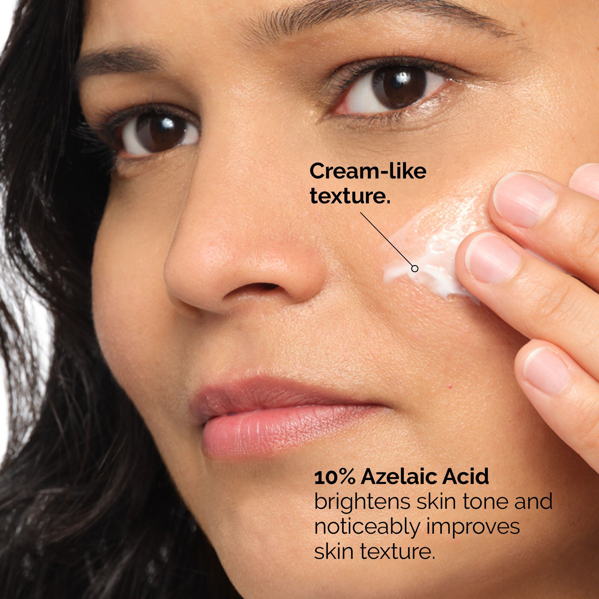 Azelaic Acid Suspension 10%