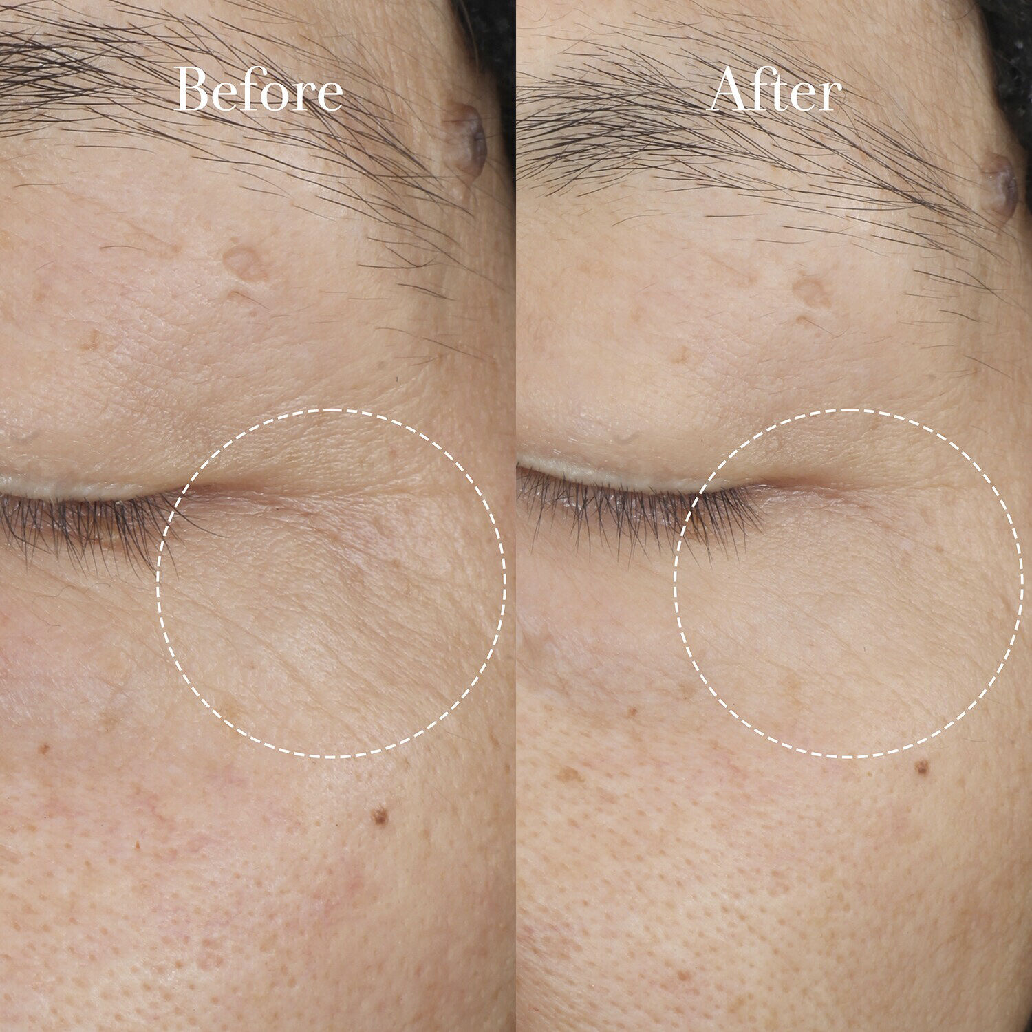 Tea Elixir Skin Resilience Activating Serum - Tea Elixir Hyaluronic Ac