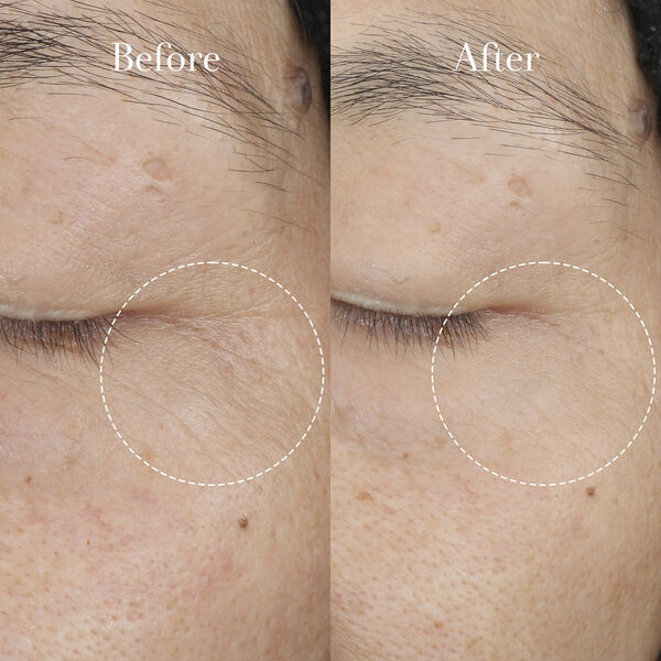 Tea Elixir Skin Resilience Activating Serum - Tea Elixir Hyaluronic Ac