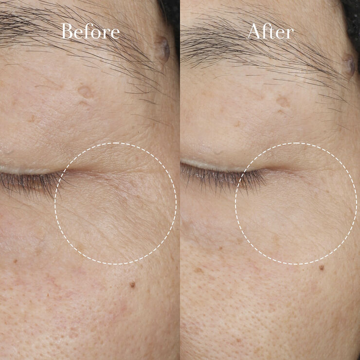 Tea Elixir Skin Resilience Activating Serum - Tea Elixir Hyaluronic Ac