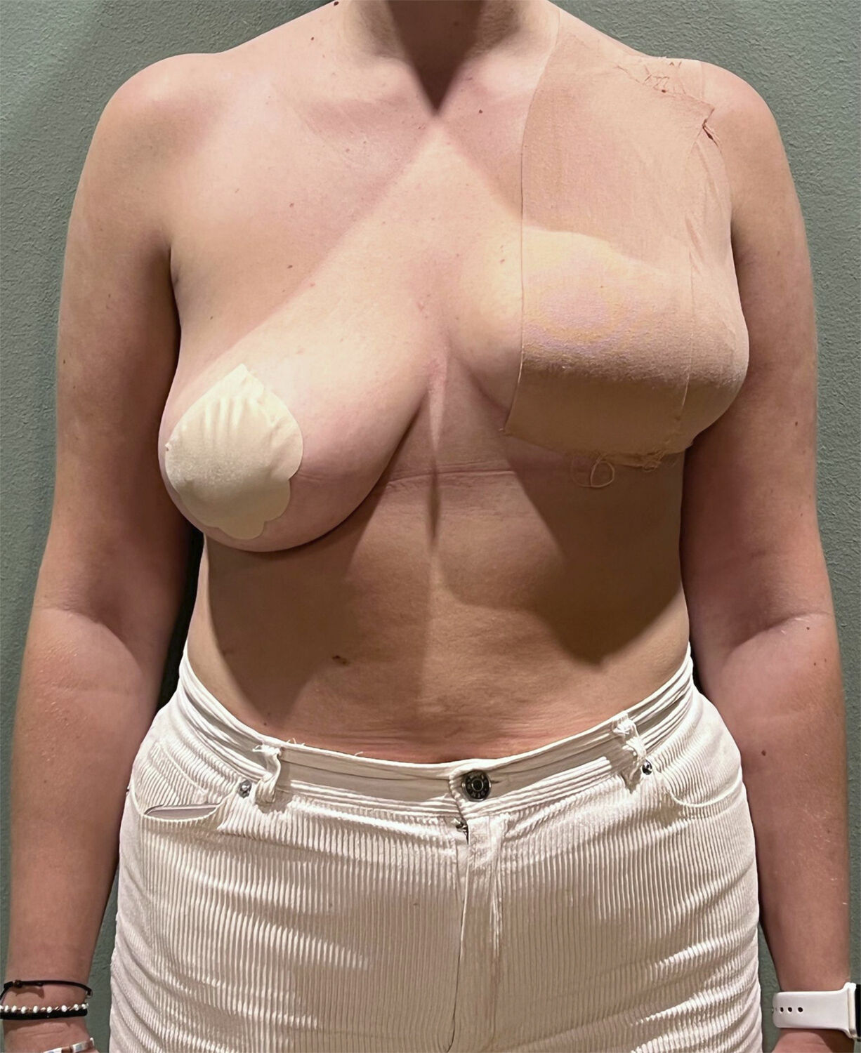 AISO Breast Tape 10cm Cholo