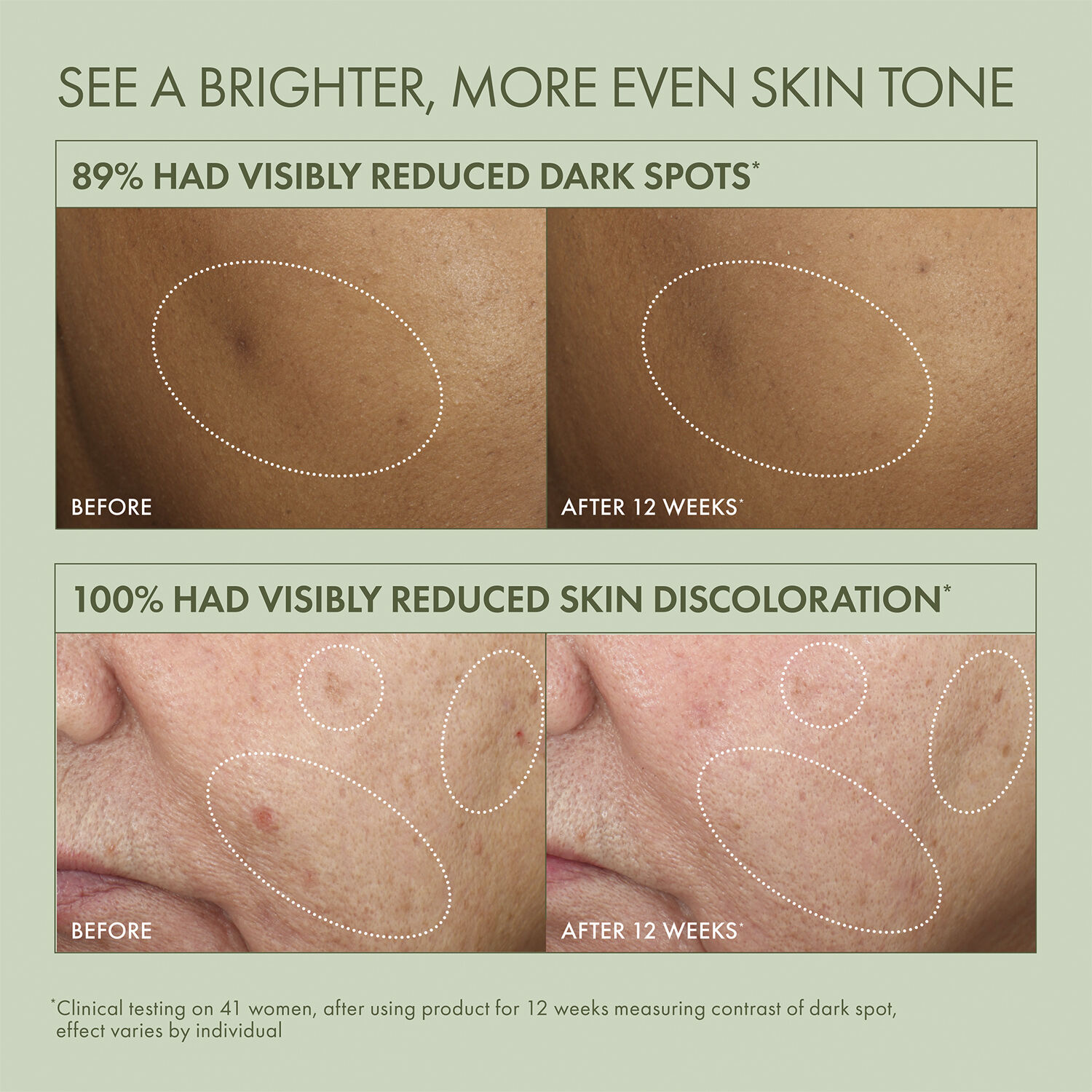 Dr. Weil Mega-Mushroom Dark Spot Corrector Serum