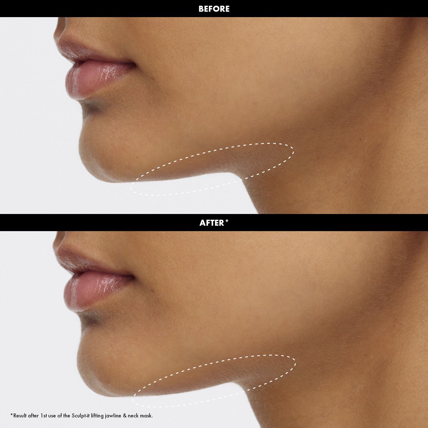 Sculpt-It Mask - Mask f&ouml;r haka och hals med lyftande effekt