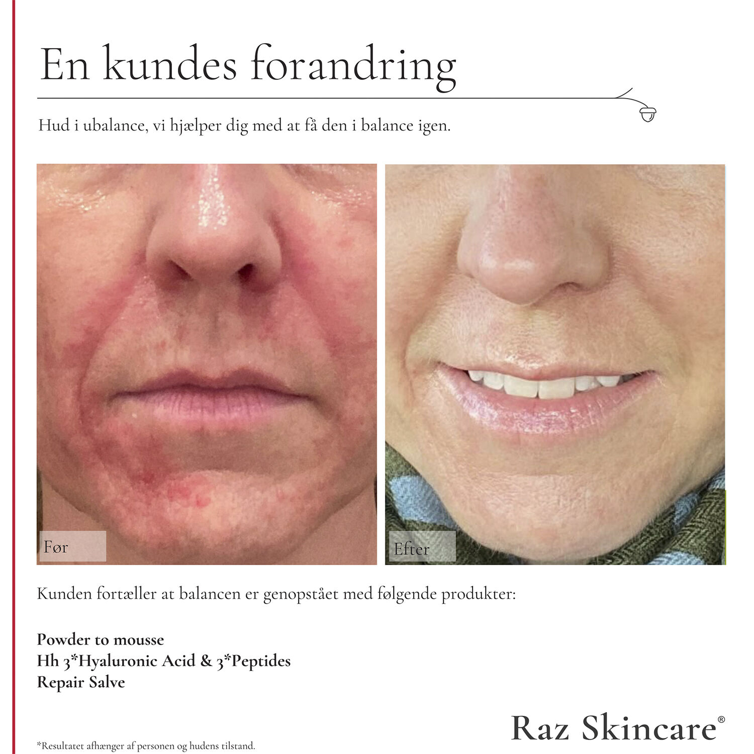 Raz Skincare Hh 3*Hyaluronic Acid & 3*Peptides 30 ml