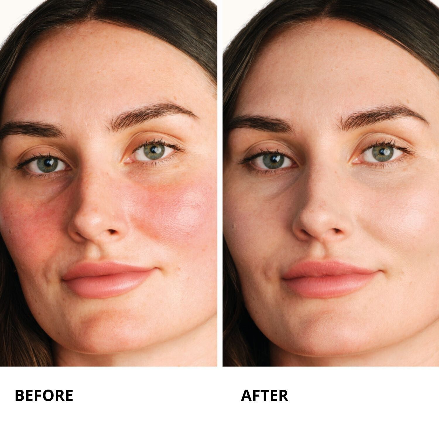 Centella Red Serum - Lugnande koncentrat med omedelbar verkan