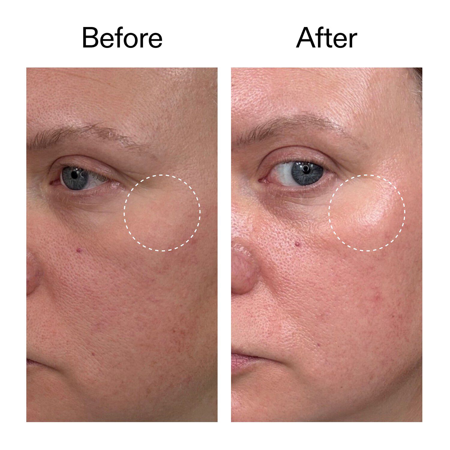 Advanced Retinal Serum - Avancerat retinalserum