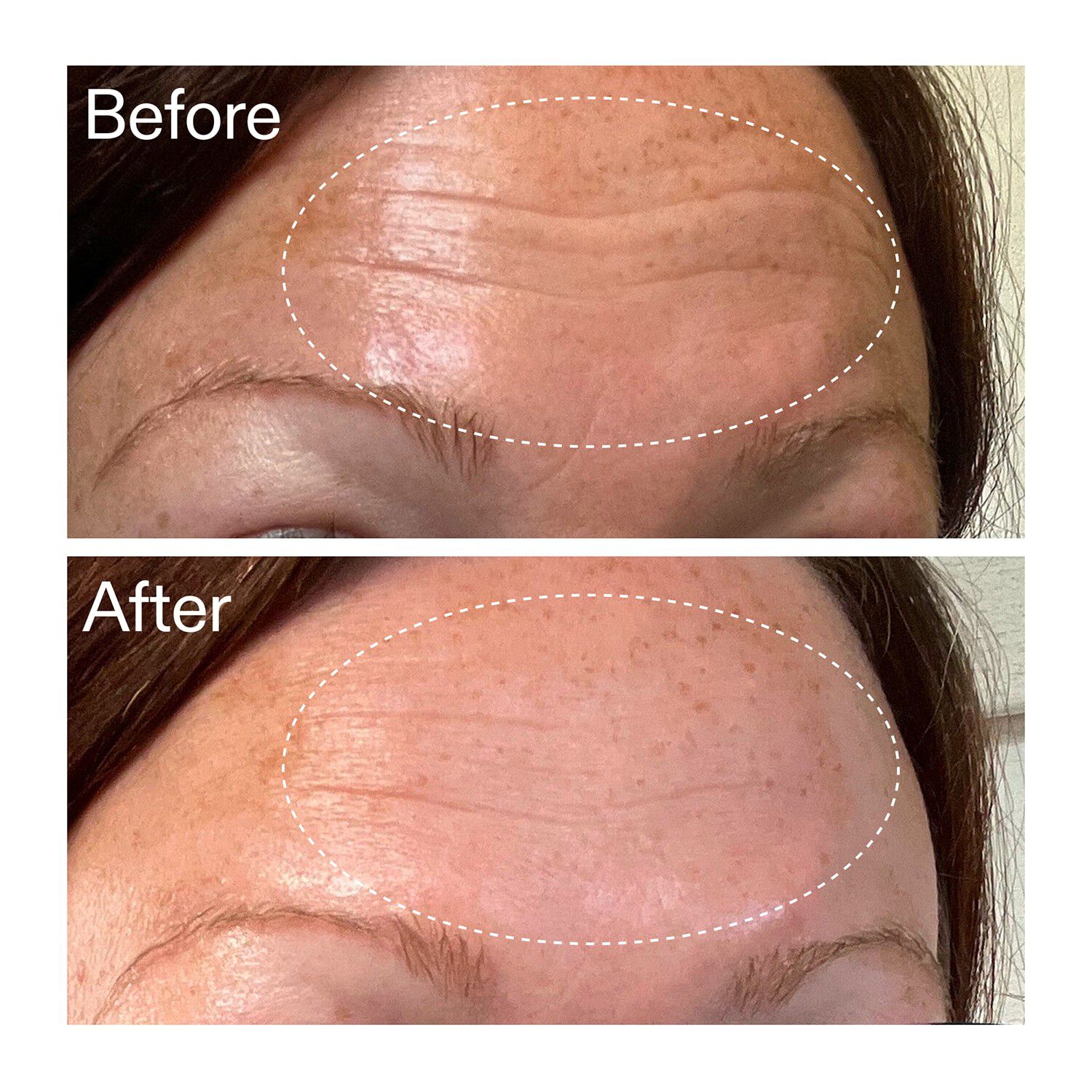 Starter Retinol Serum - Retinolserum f&ouml;r nyb&ouml;rjare