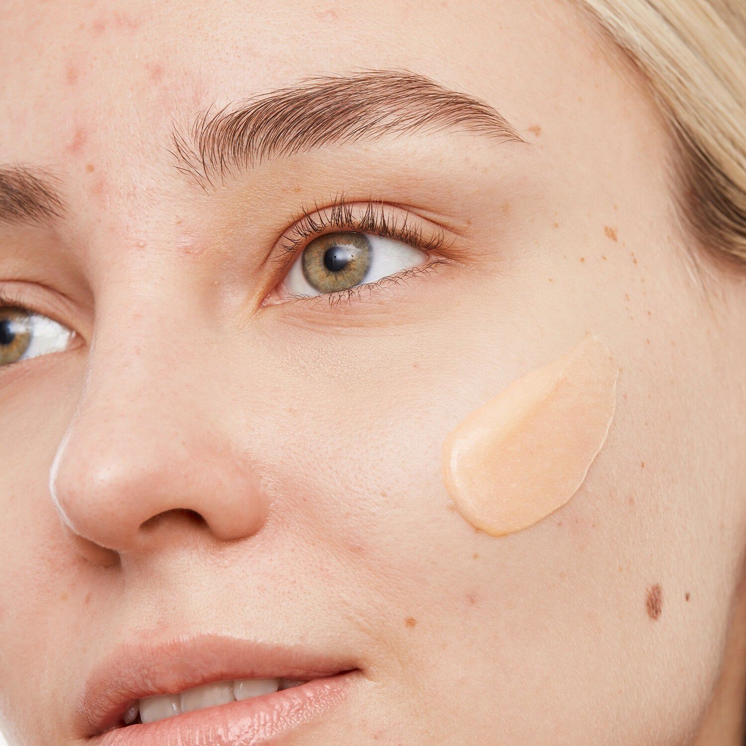 Reng&ouml;ringsgel - Mot akne