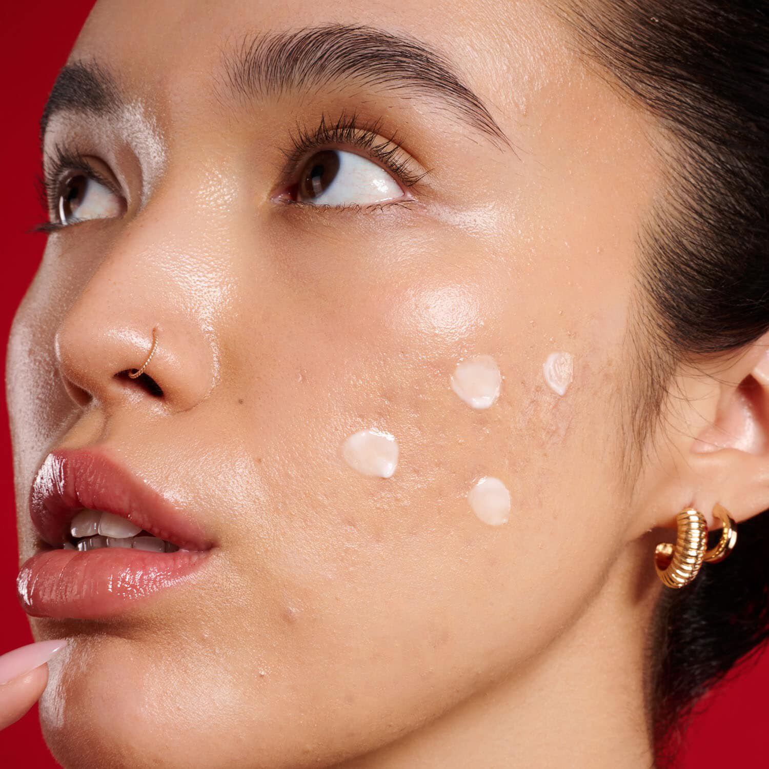 The Spot Stop - AHA + PHA-l&ouml;sning mot orenheter