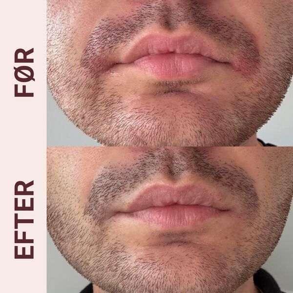 Pudderdåserne Skæl serum