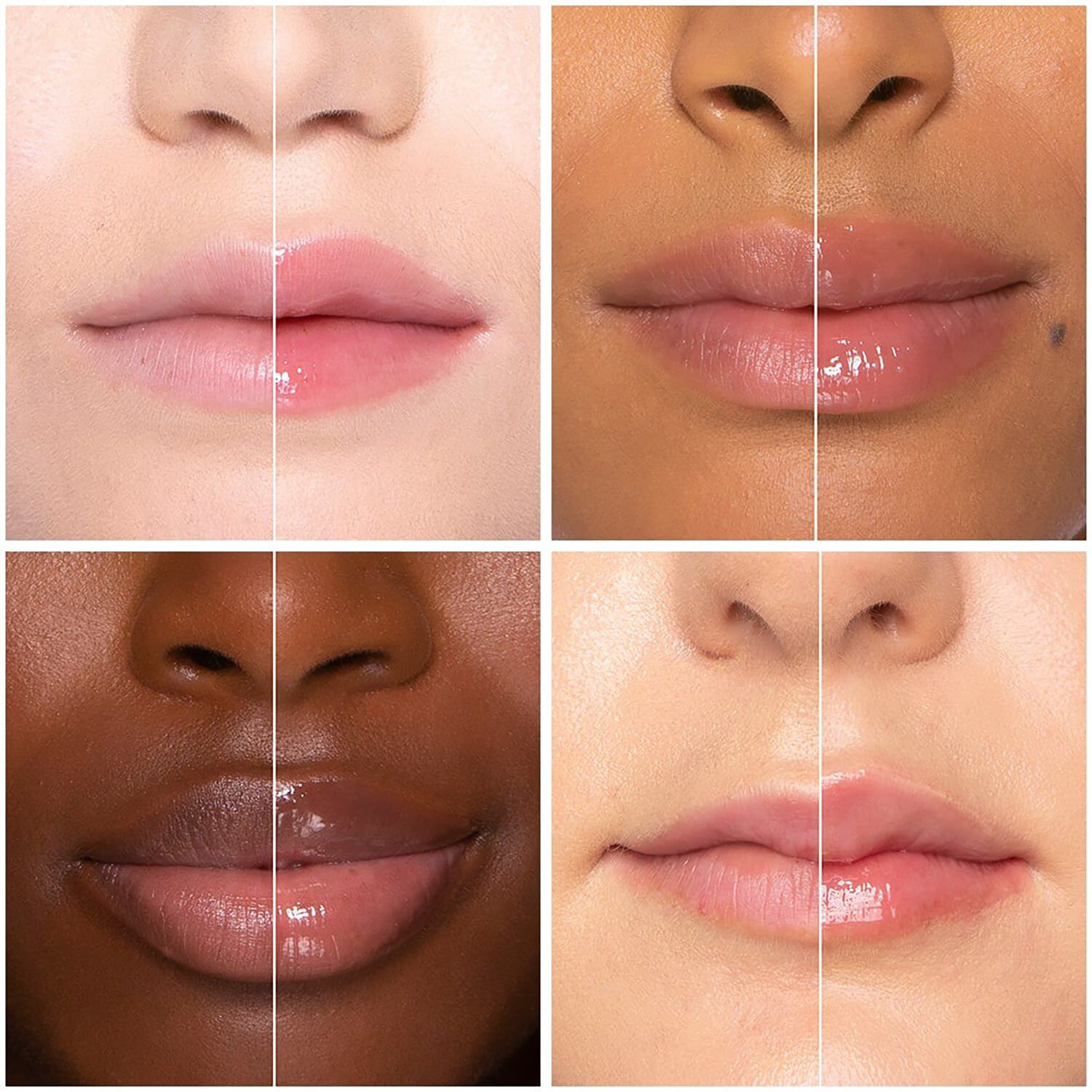 Lip Injection Extreme - Rejsest&oslash;rrelse