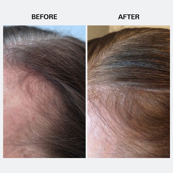 Youth Juice - Kollagenbehandling för hårbotten