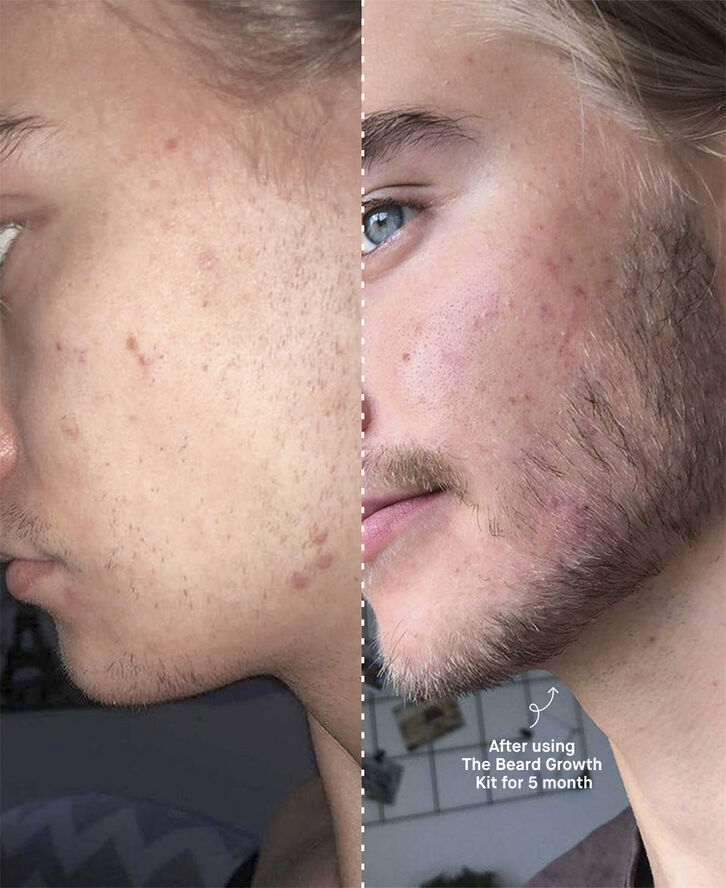 The Beard Growth Kit