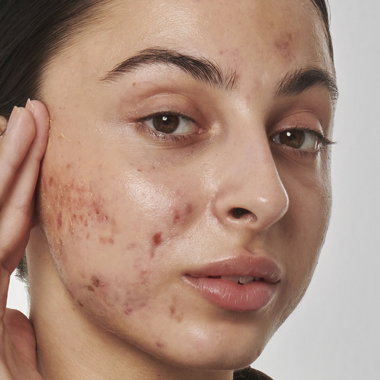 Scar, mark and wrinkle solution with 1% retinol - Face serum