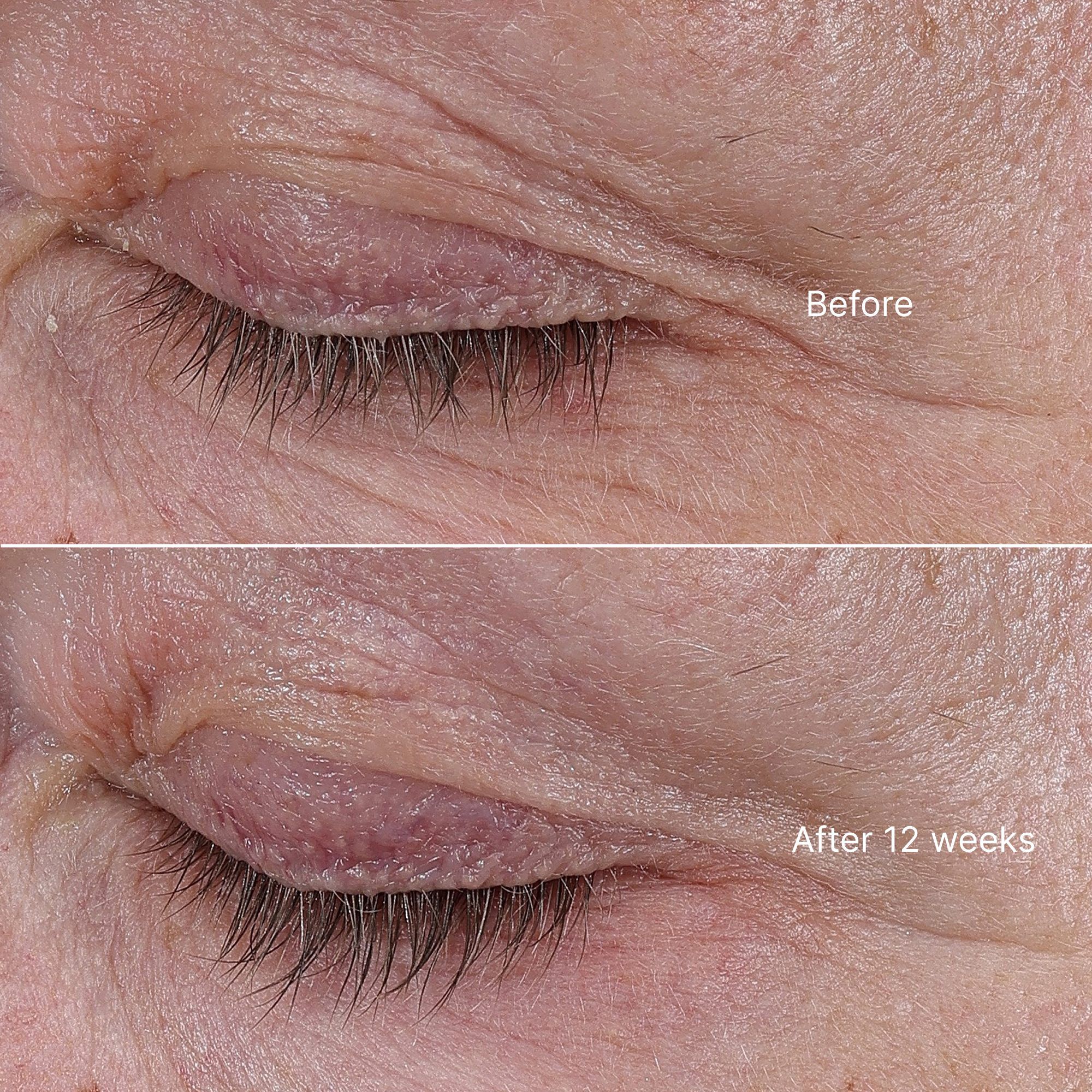 The Rejuvenating Eye Cream 15ml