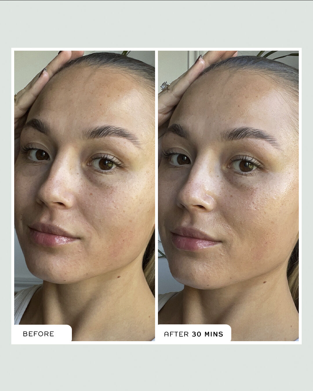 Evercalm Barrier Support Elixir 30ml